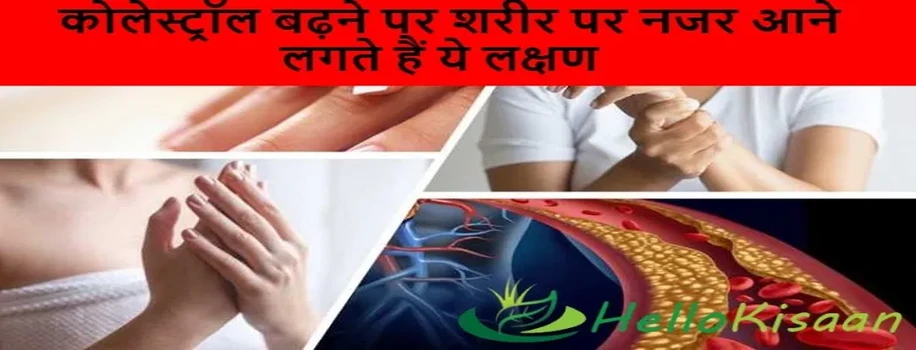 केले और मूली से नेकलेगी किडनी की पथरी