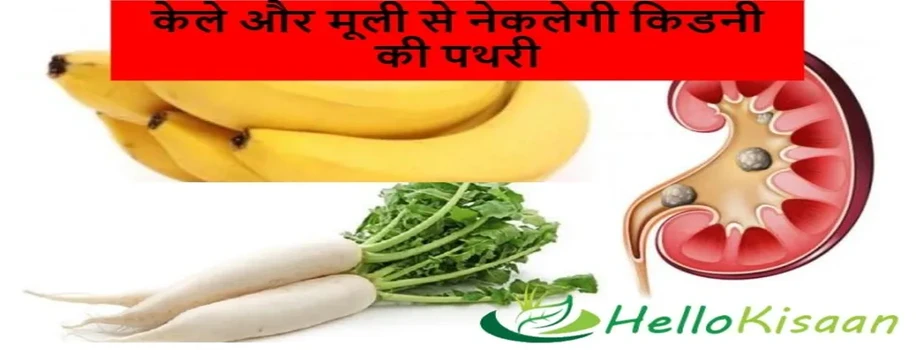 केले और मूली से नेकलेगी किडनी की पथरी