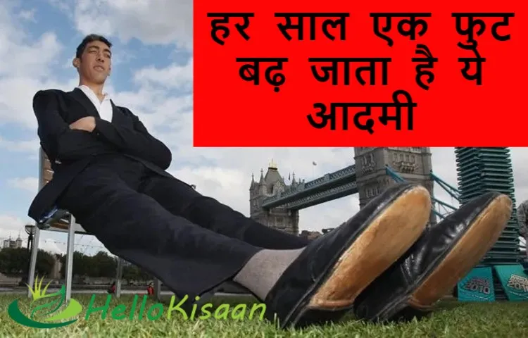 हर साल एक फुट बढ़ जाता है ये आदमी