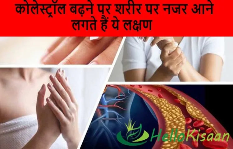 केले और मूली से नेकलेगी किडनी की पथरी