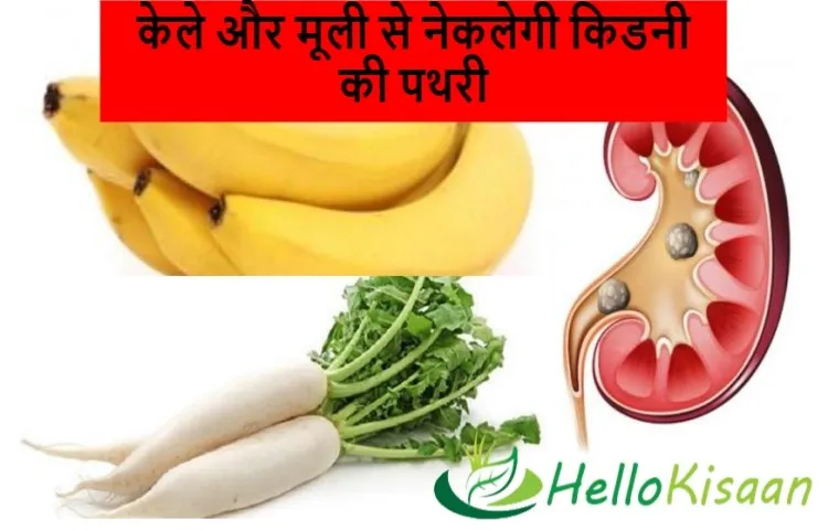 केले और मूली से नेकलेगी किडनी की पथरी